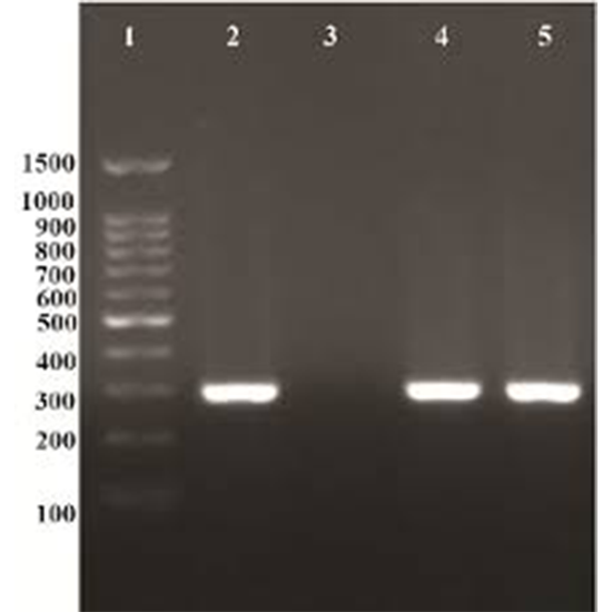 Chlamydia Trachomatis PCR